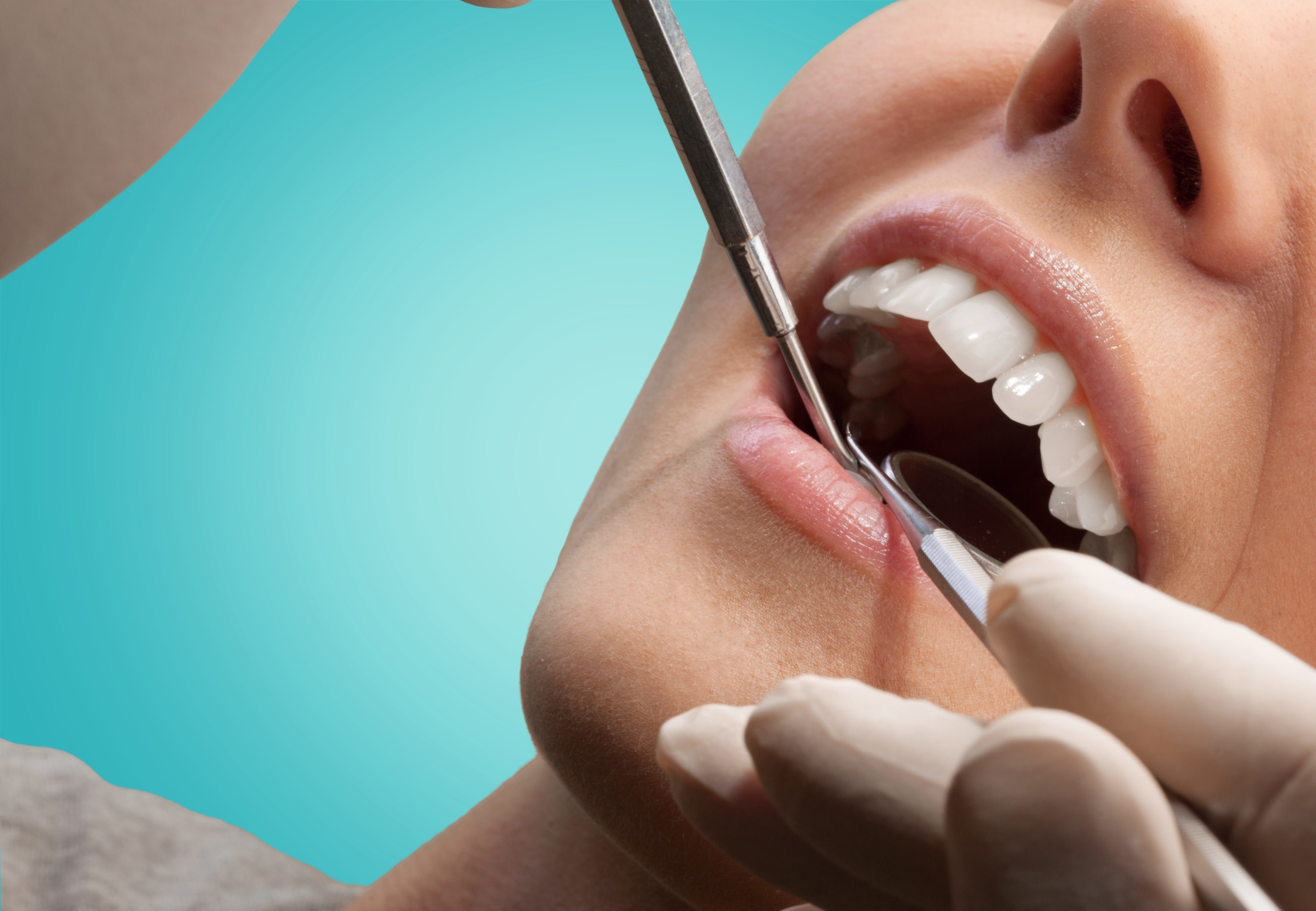 Complete Dental Exams at Timbercrest Dental Center in Appleton, WI