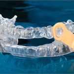 sleep apnea and snoring appliance by Timbercrest Dental Center in Appleton, WI