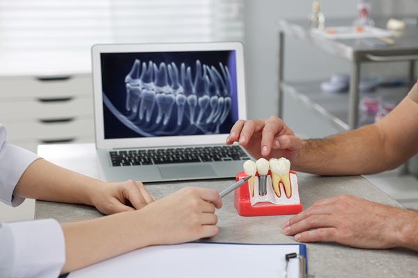 Missing A Single Tooth? Consider A Dental Implant